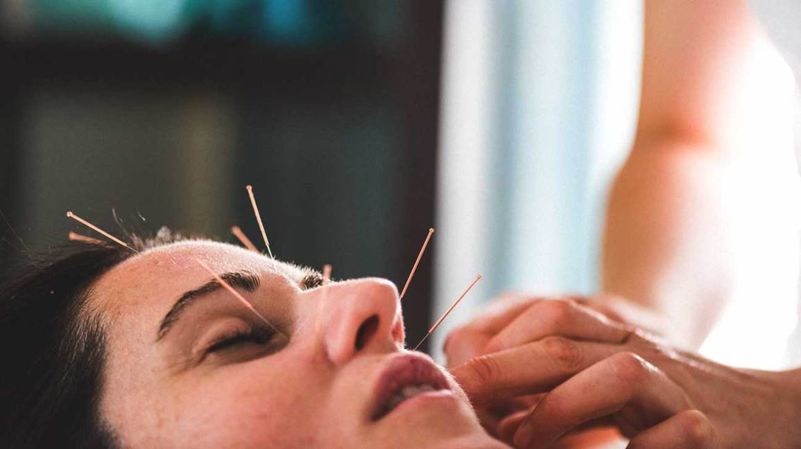 What You Need To Know About Good Acupuncturist