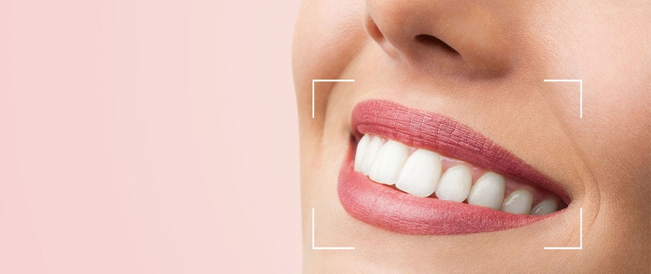 Dental Braces and Aligners: What They Treat & How They Work
